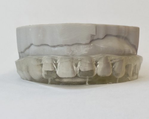 Injection Mould